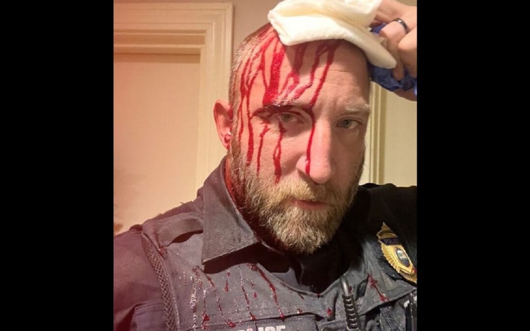 Marshfield Officers Injured During Well Being Check