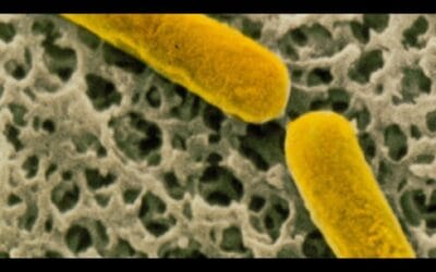 Botulism Cases Linked To Milton Spa